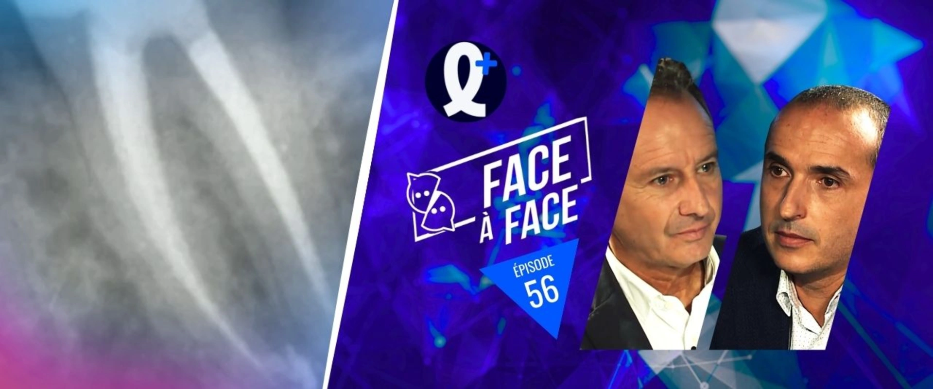 Inlays-Onlays : temporisation quand pronostic biologique incertain