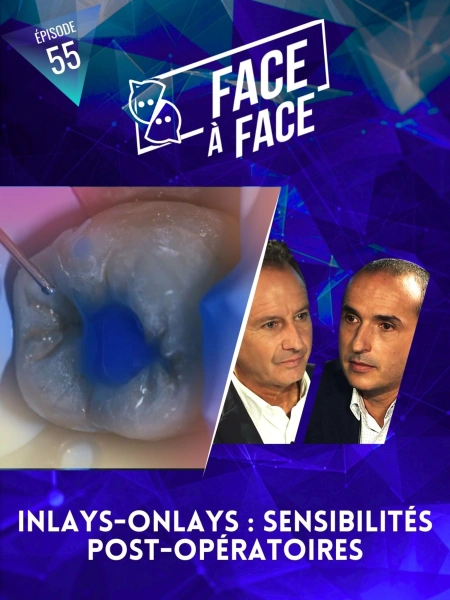 Inlays-Onlays : sensibilités post-opératoires