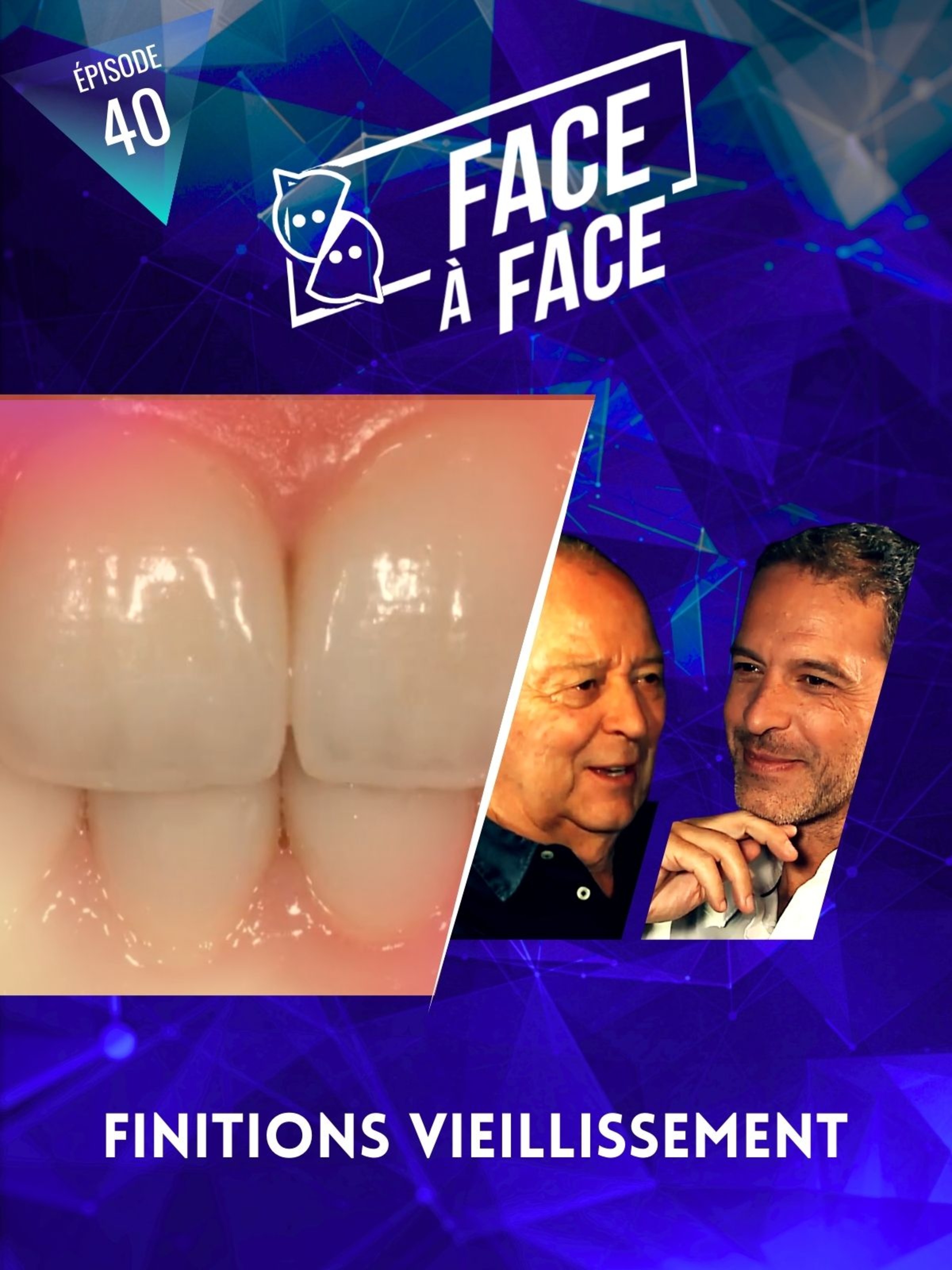 Facettes : finitions et vieillissement