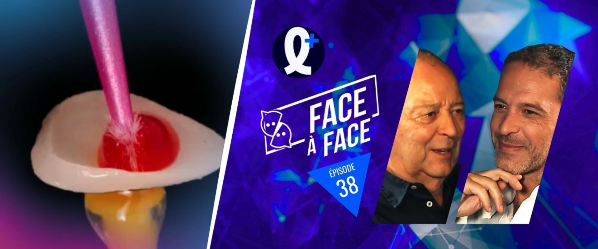 Facettes : collage généralités