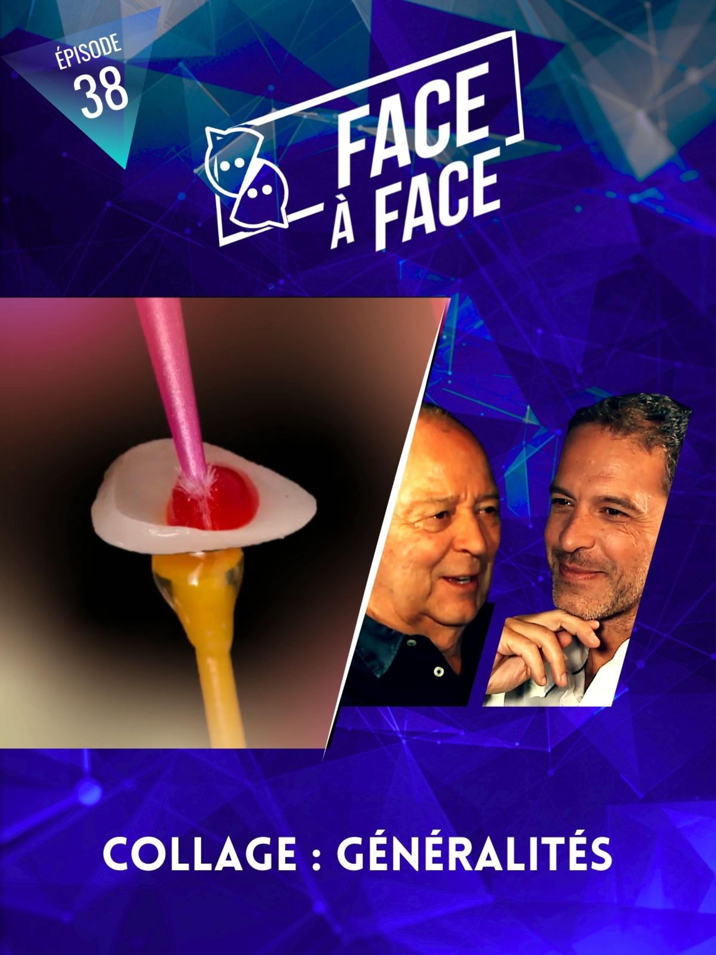 Facettes : collage généralités