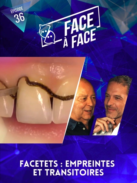 Facettes : empreintes et transitoires