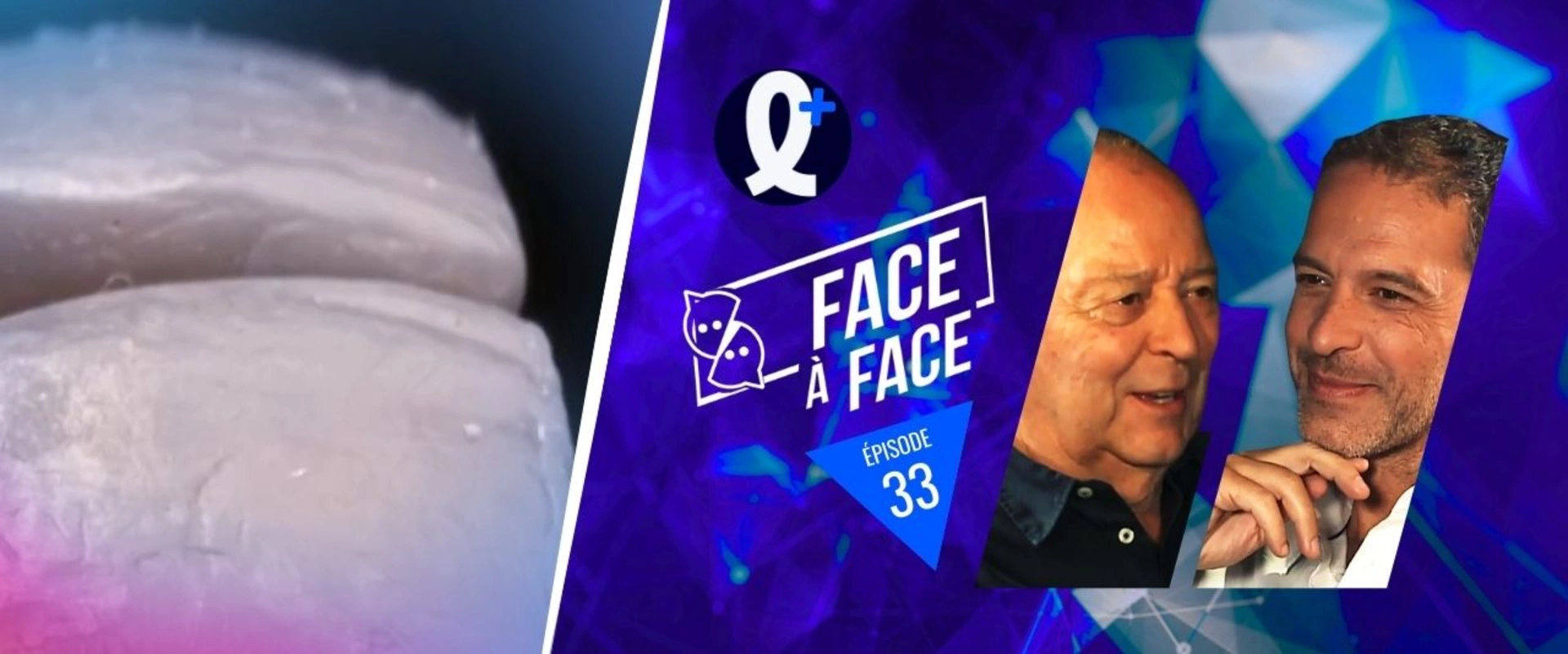 Facettes : empreintes préliminaires