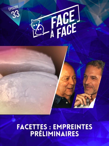 Facettes : empreintes préliminaires