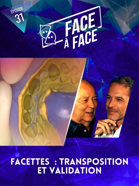 Facettes : Transposition et validation