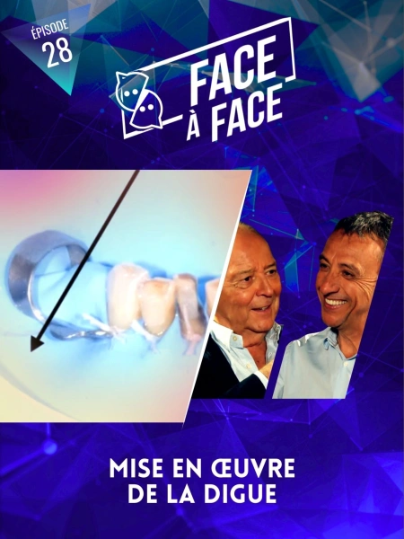 Mise en œuvre de la digue