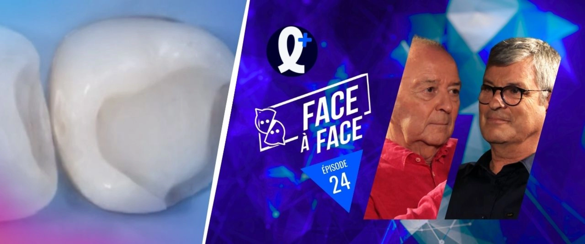 Scellement dentinaire immédiat