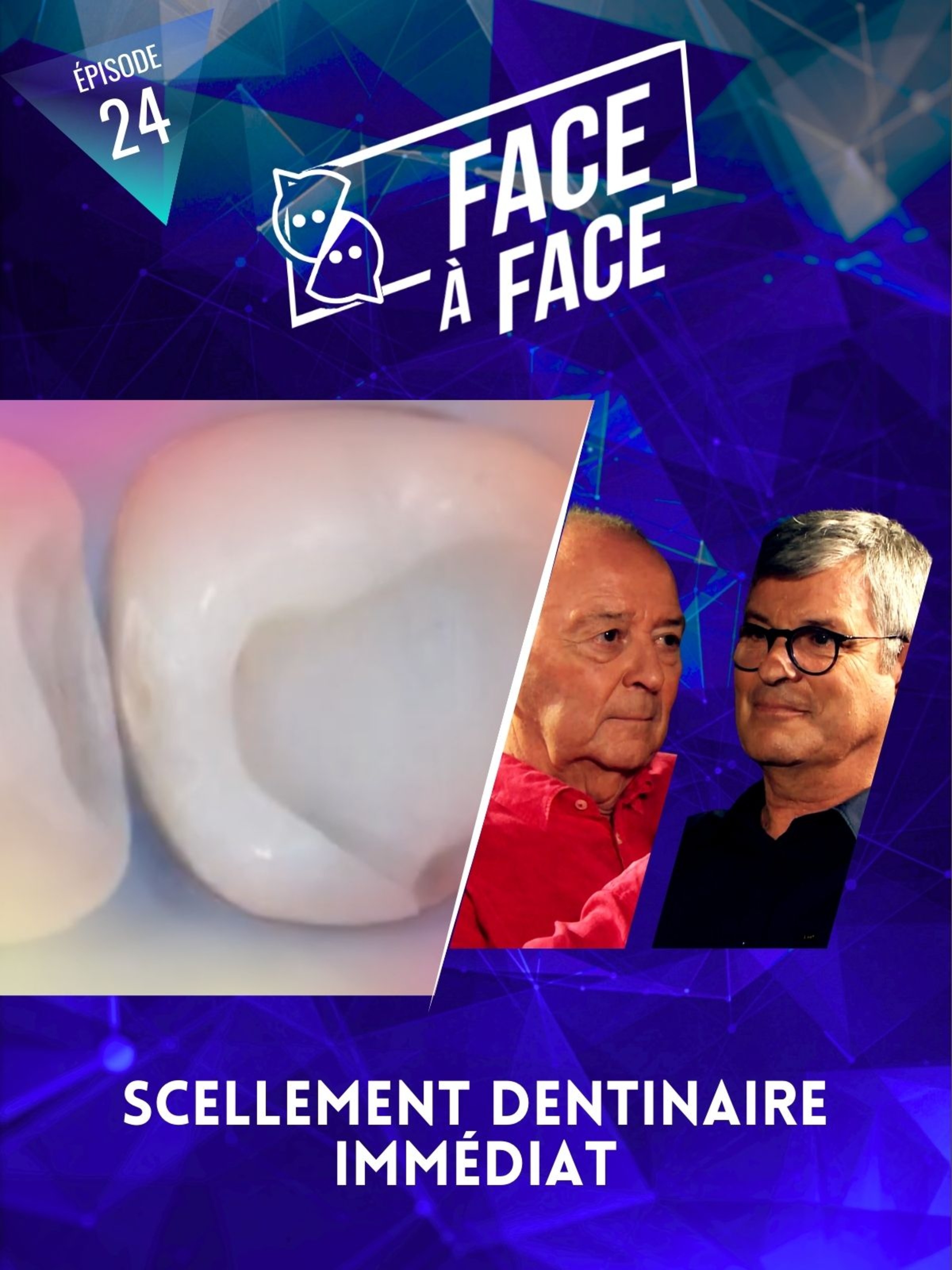 Scellement dentinaire immédiat