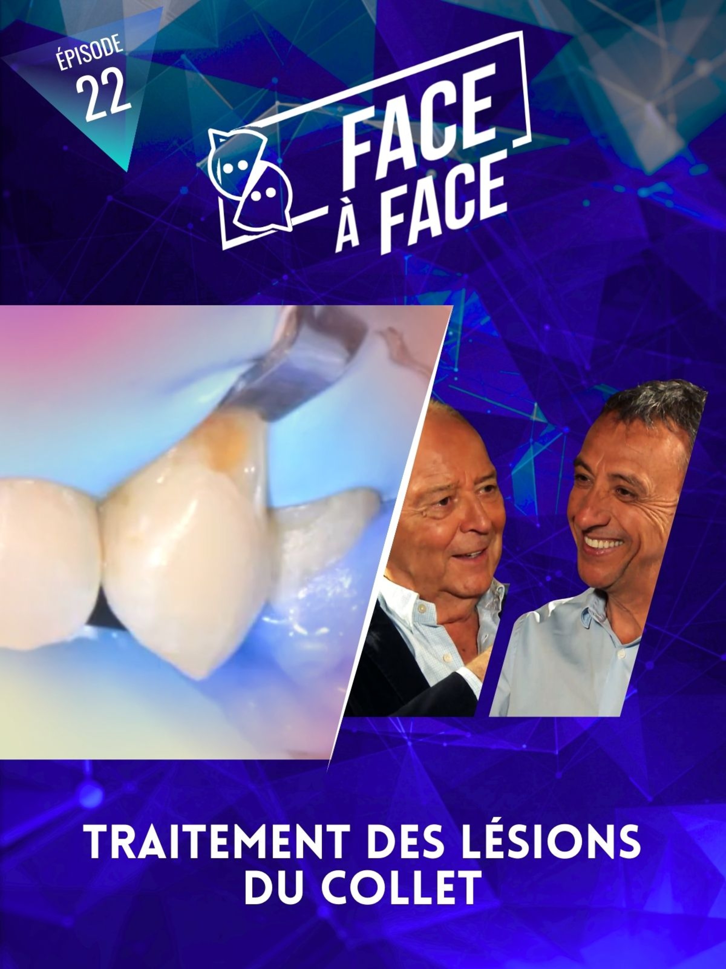 Traitements des lésions du collet