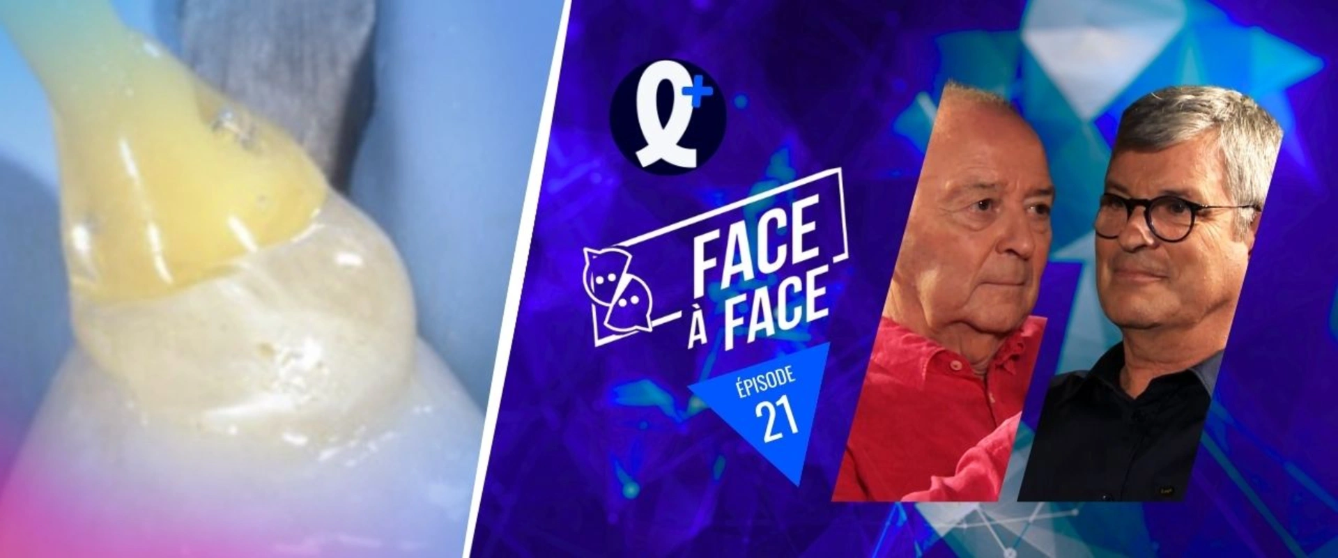 Adhésifs : Analyse de leurs performances session 2