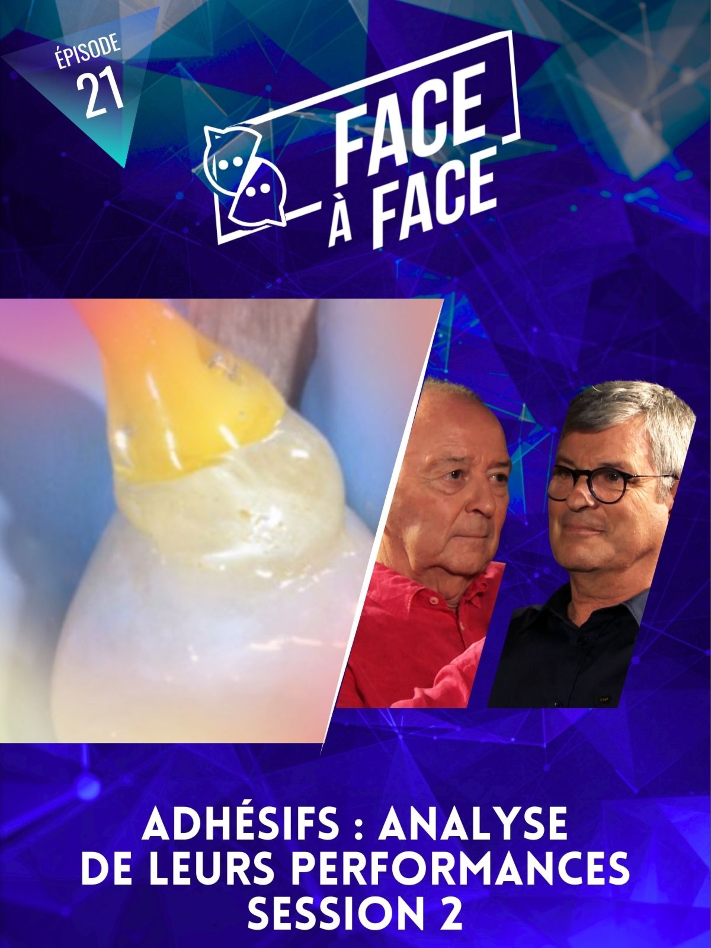 Adhésifs : Analyse de leurs performances session 2
