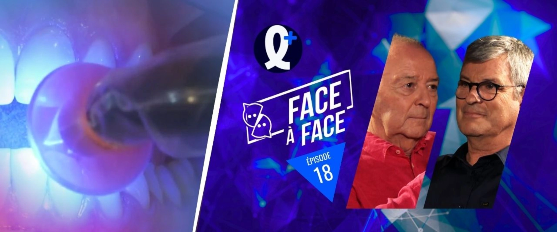 Choix du système adhésif