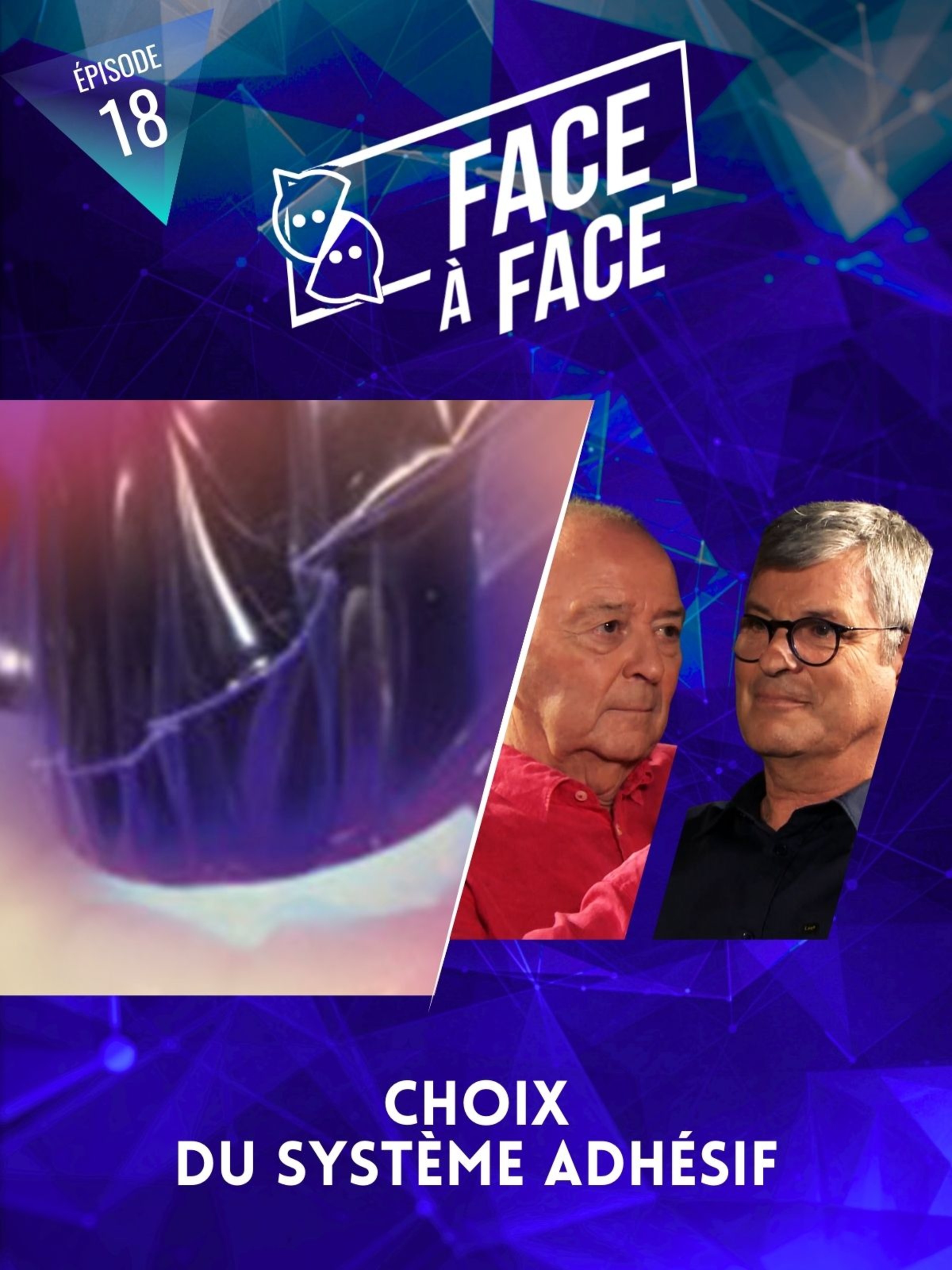 Choix du système adhésif