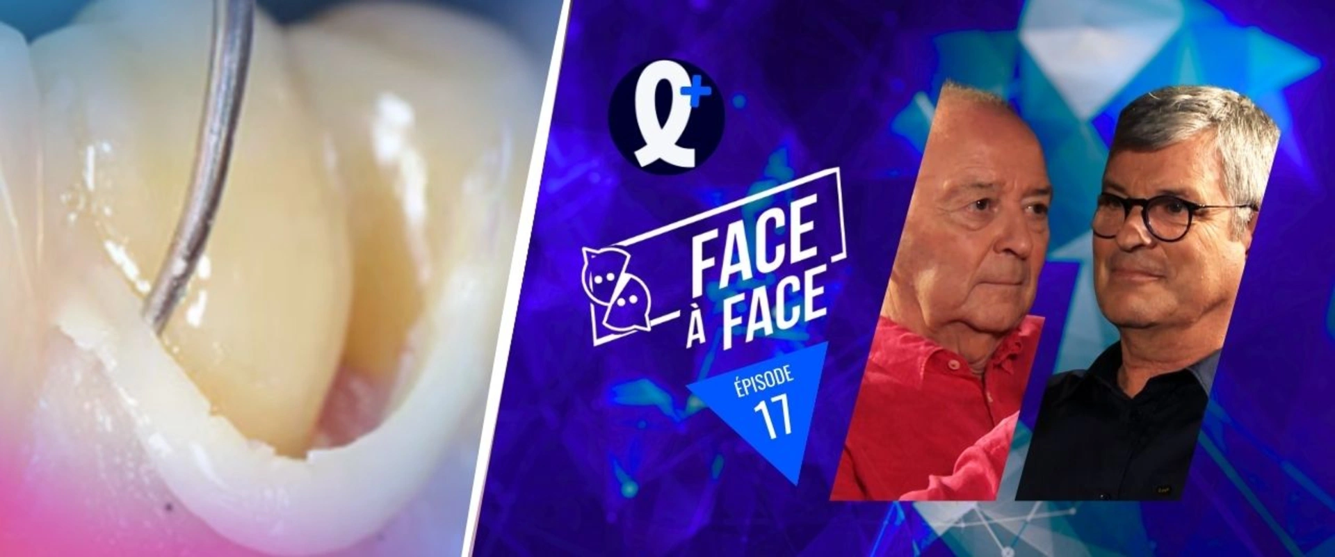 Ciments, colles, scellements sans collage