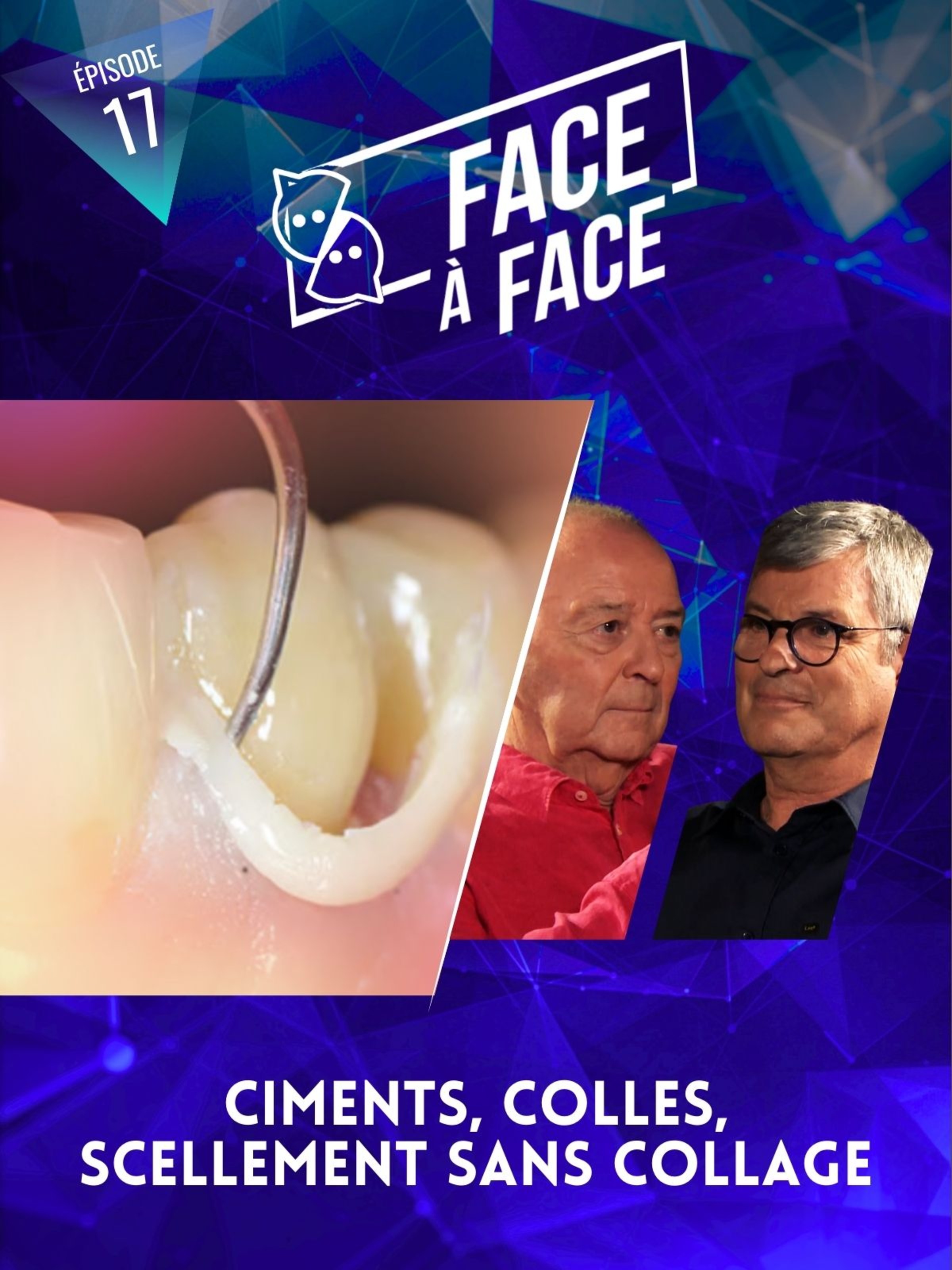 Ciments, colles, scellements sans collage