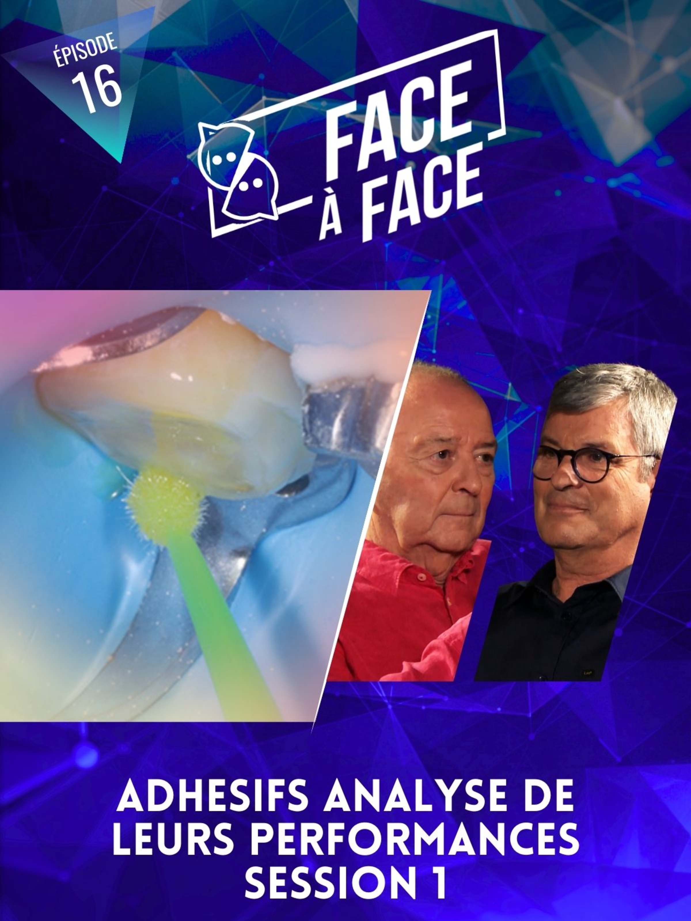 Adhésifs analyse de leurs performances session 1