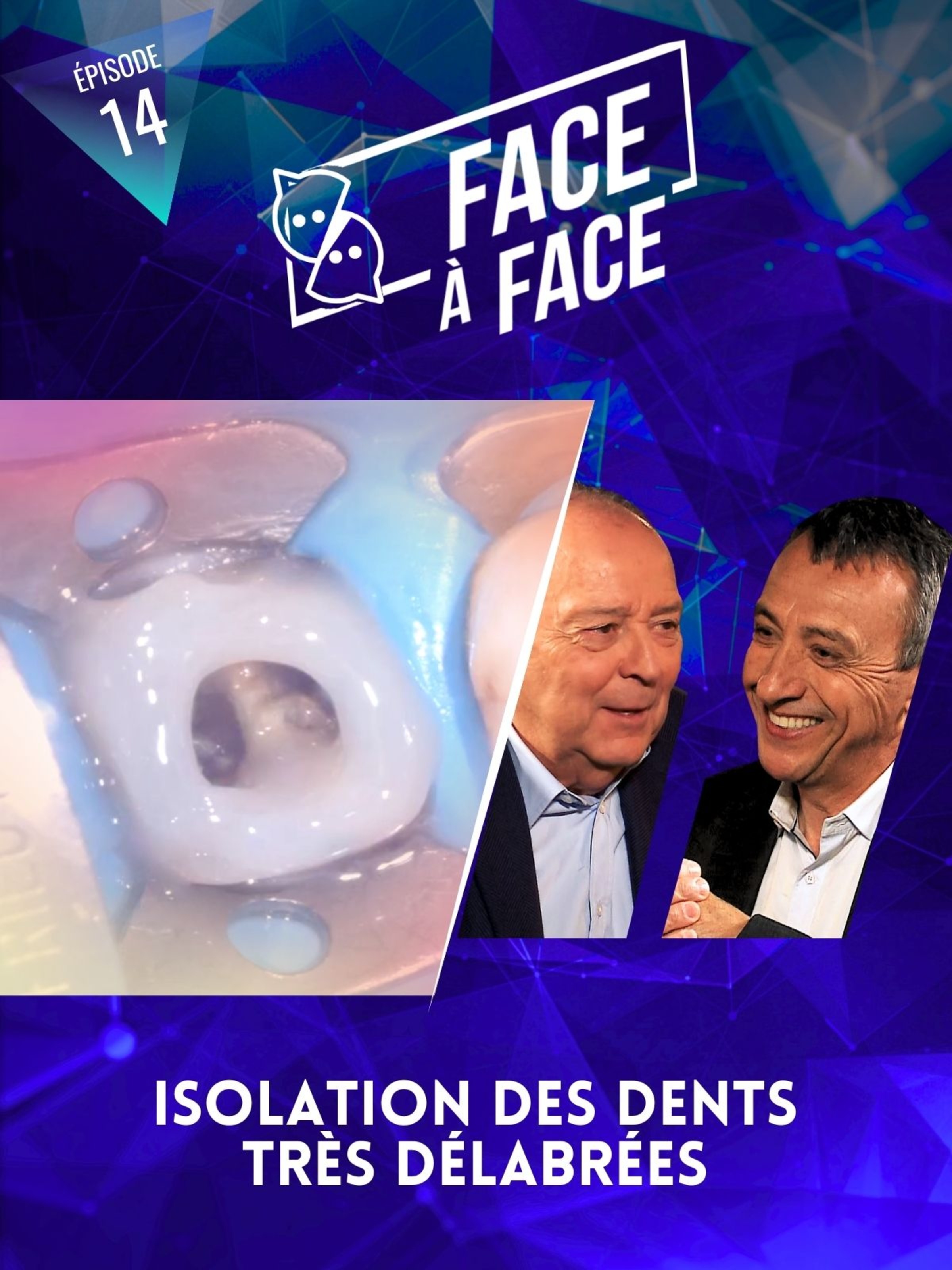 Isolations des dents très délabrées