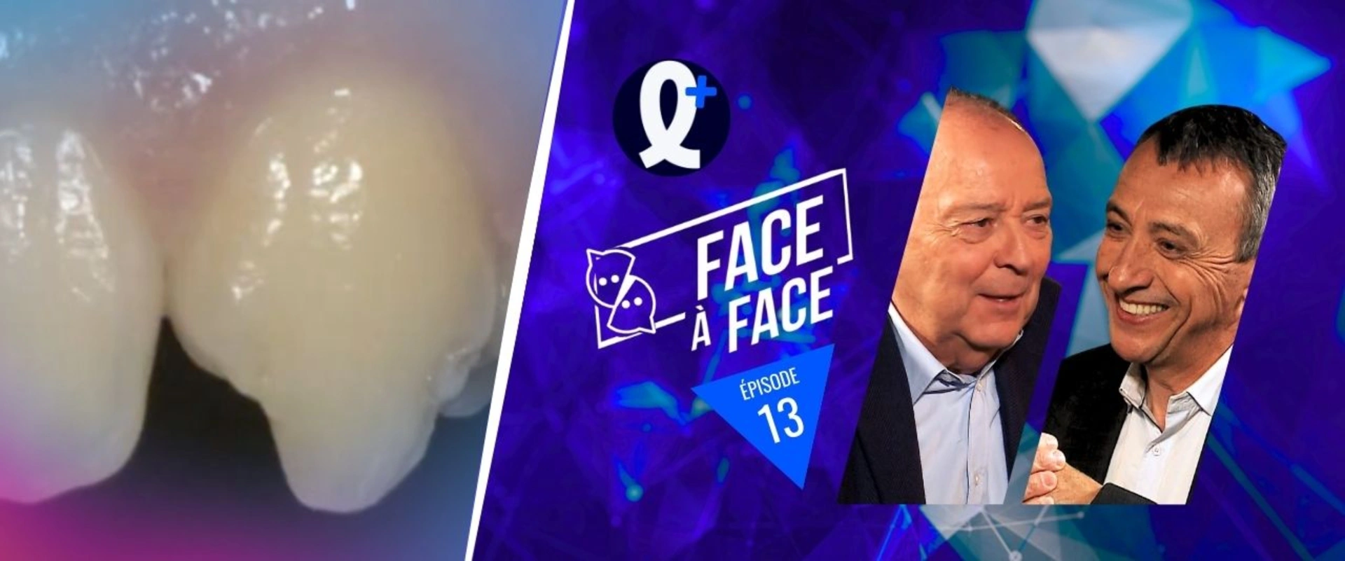 Modifications esthétiques importantes localisées