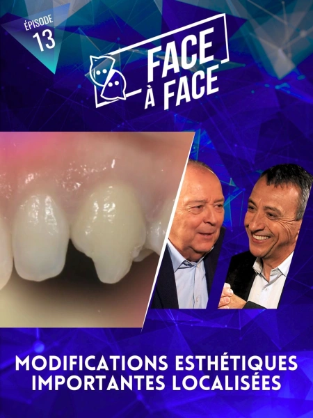Modifications esthétiques importantes localisées
