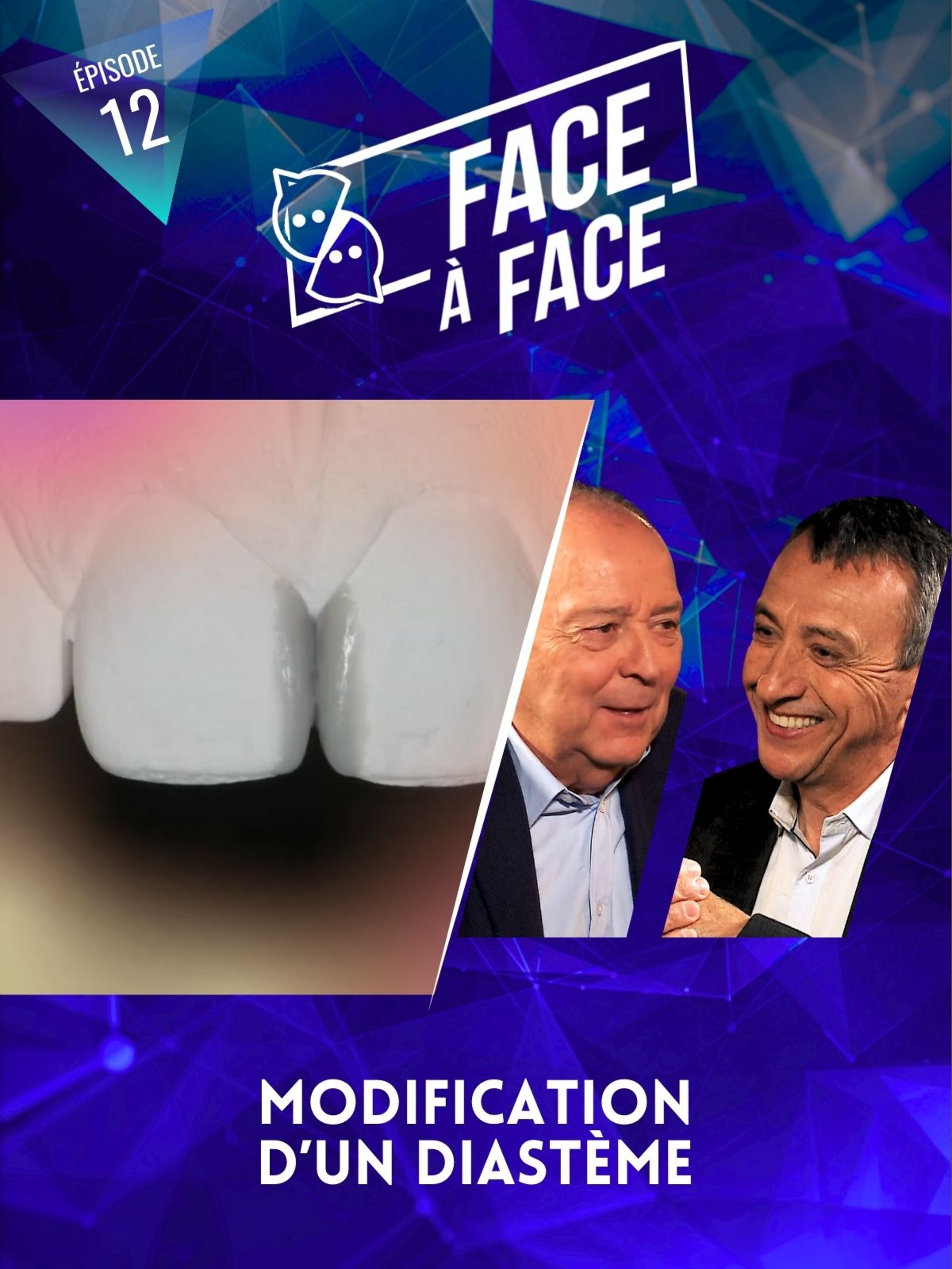 Modification d'un diastème