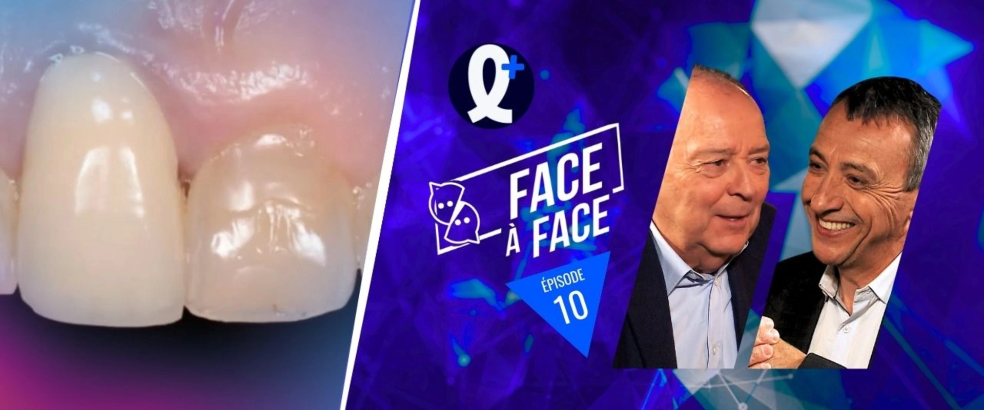 Alignement des collets