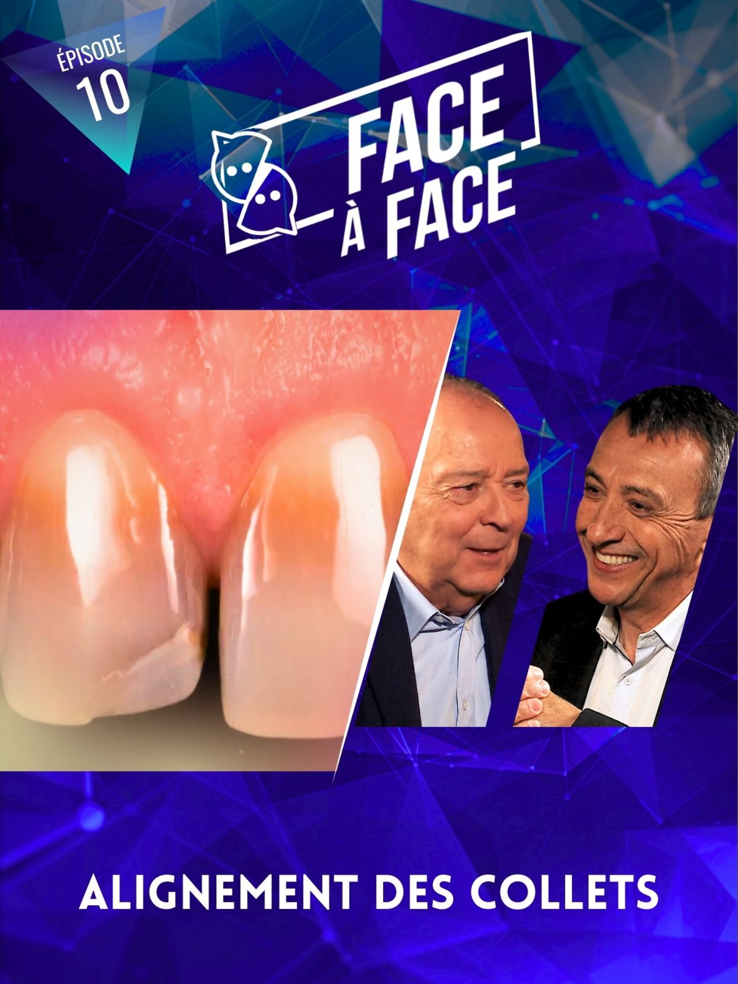 Alignement des collets