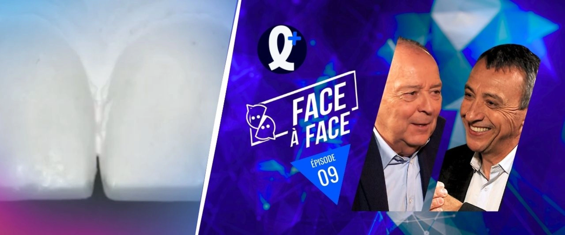 Usures modérées, gestion du projet