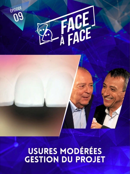 Usures modérées, gestion du projet