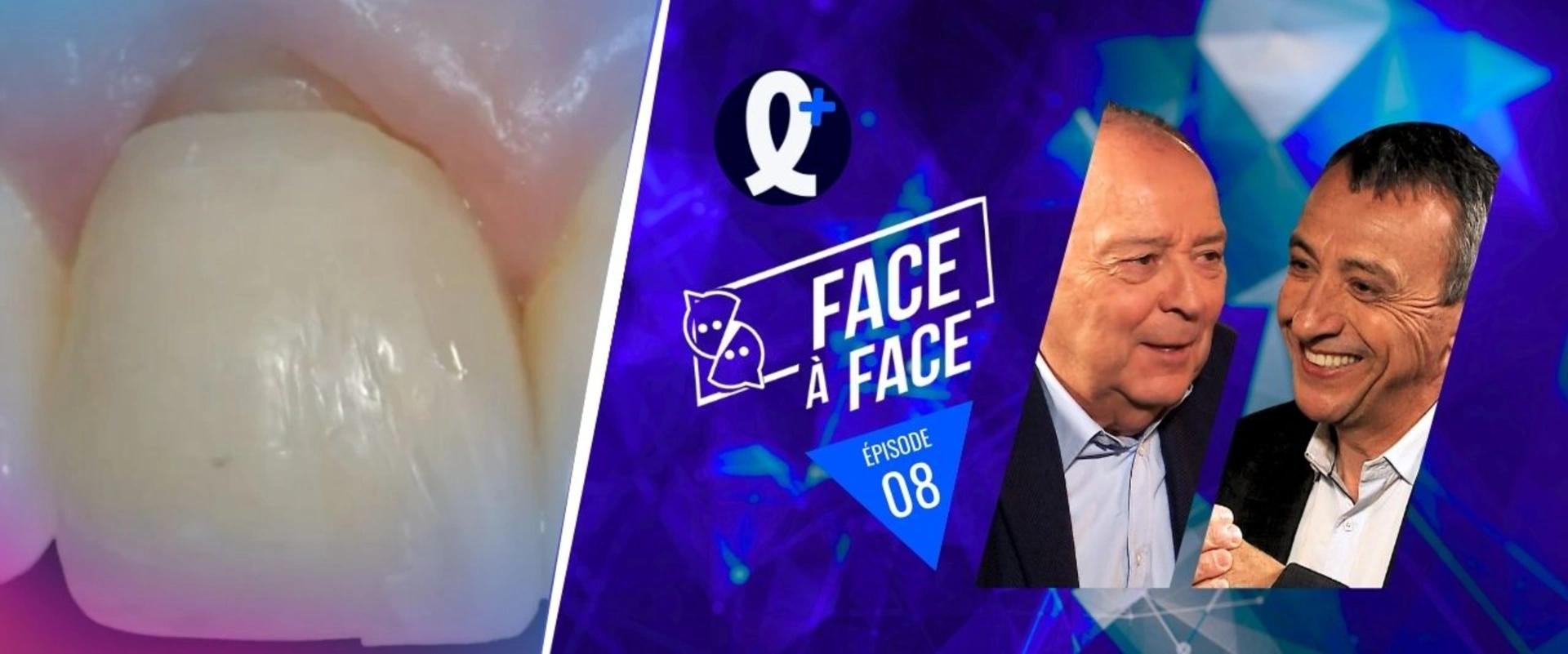 Extrusion réhabilitation