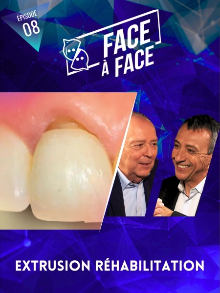 Extrusion réhabilitation