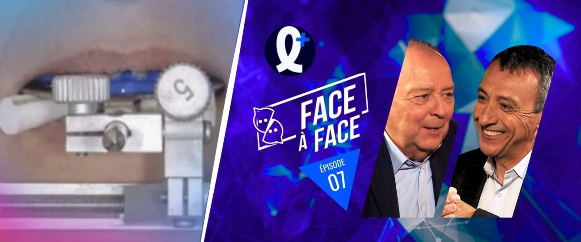 Projet esthétique et clefs de reproduction