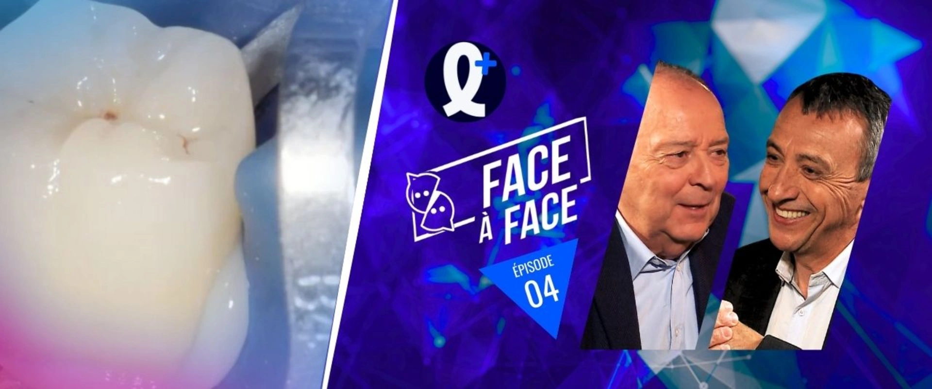 Isolation d'une dent déchaussée