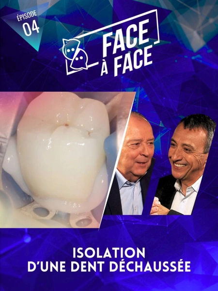 Isolation d'une dent déchaussée