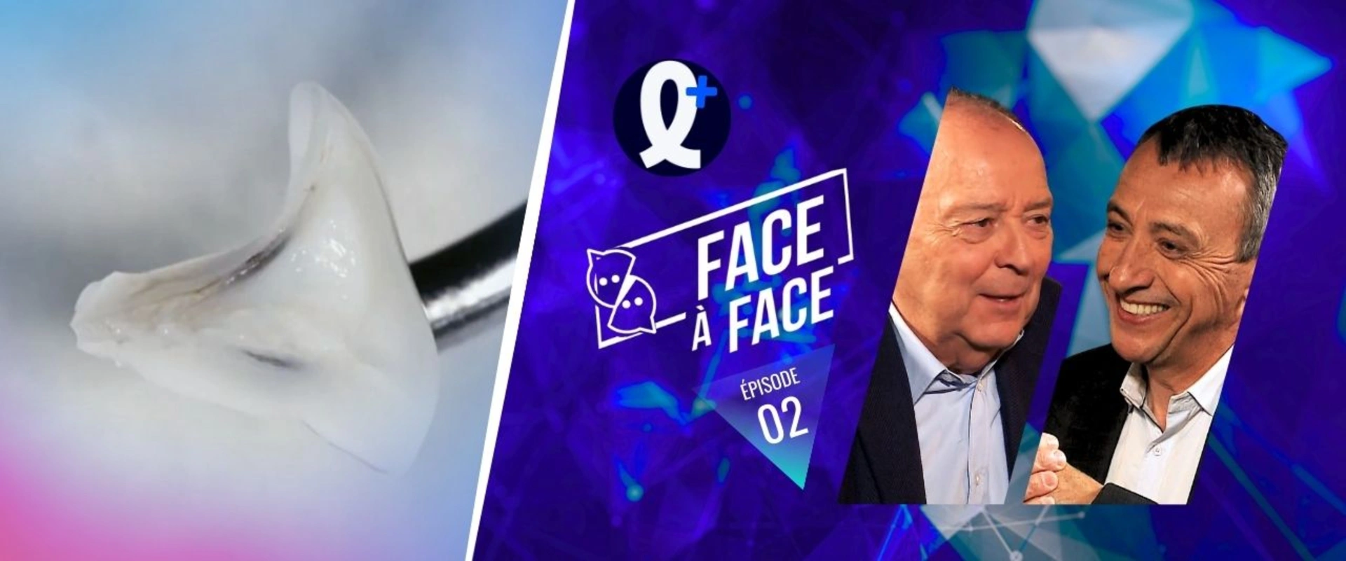 Personnalisation d'une matrice