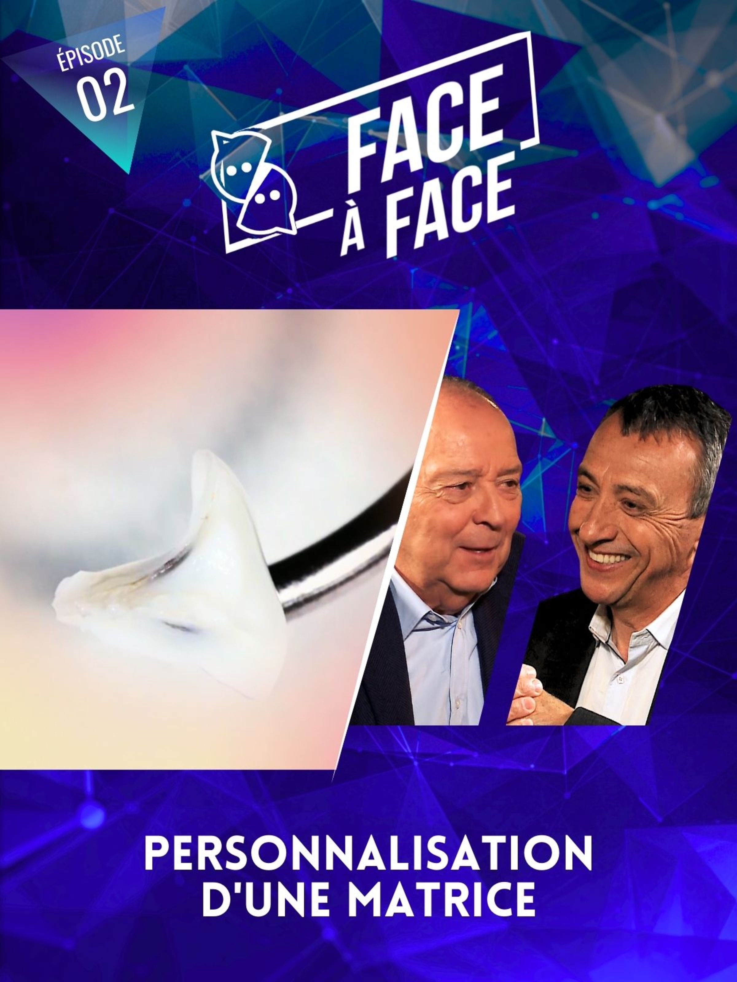 Personnalisation d'une matrice