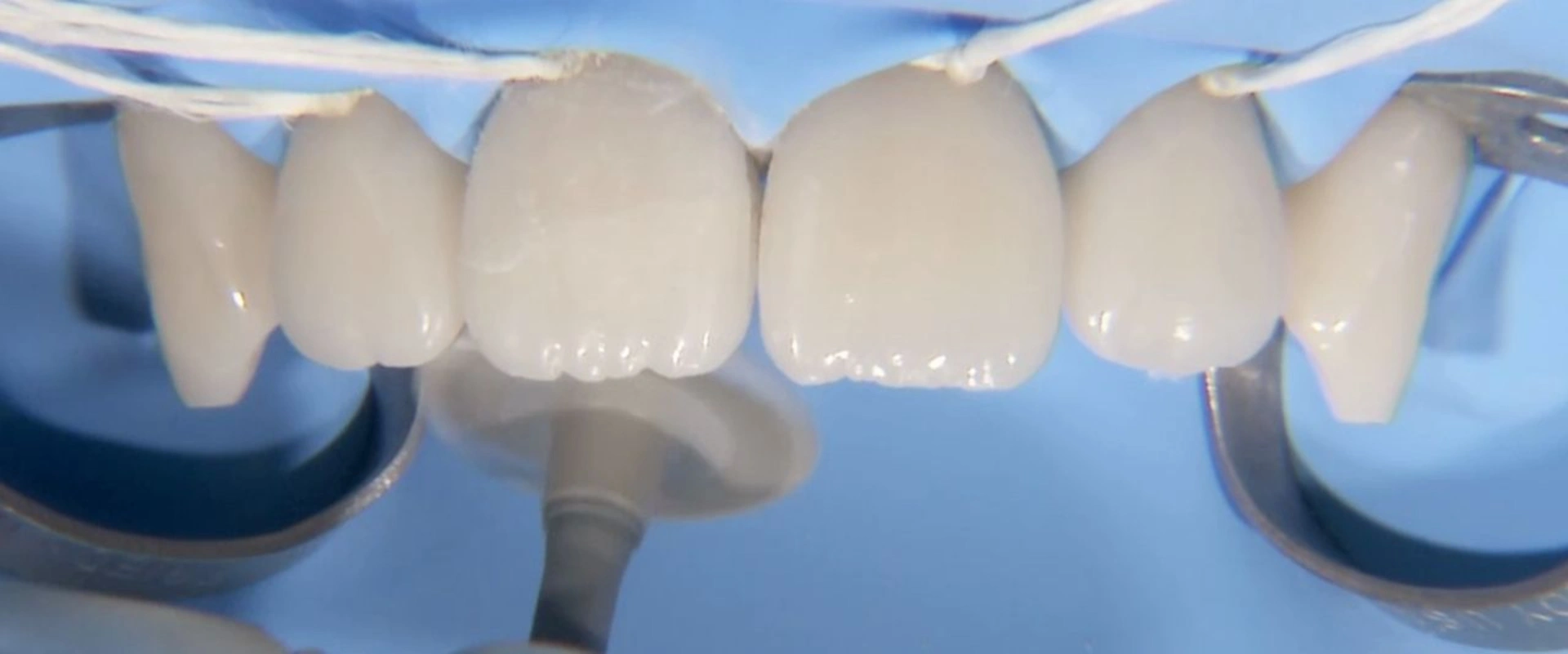 Collage d'un fragment