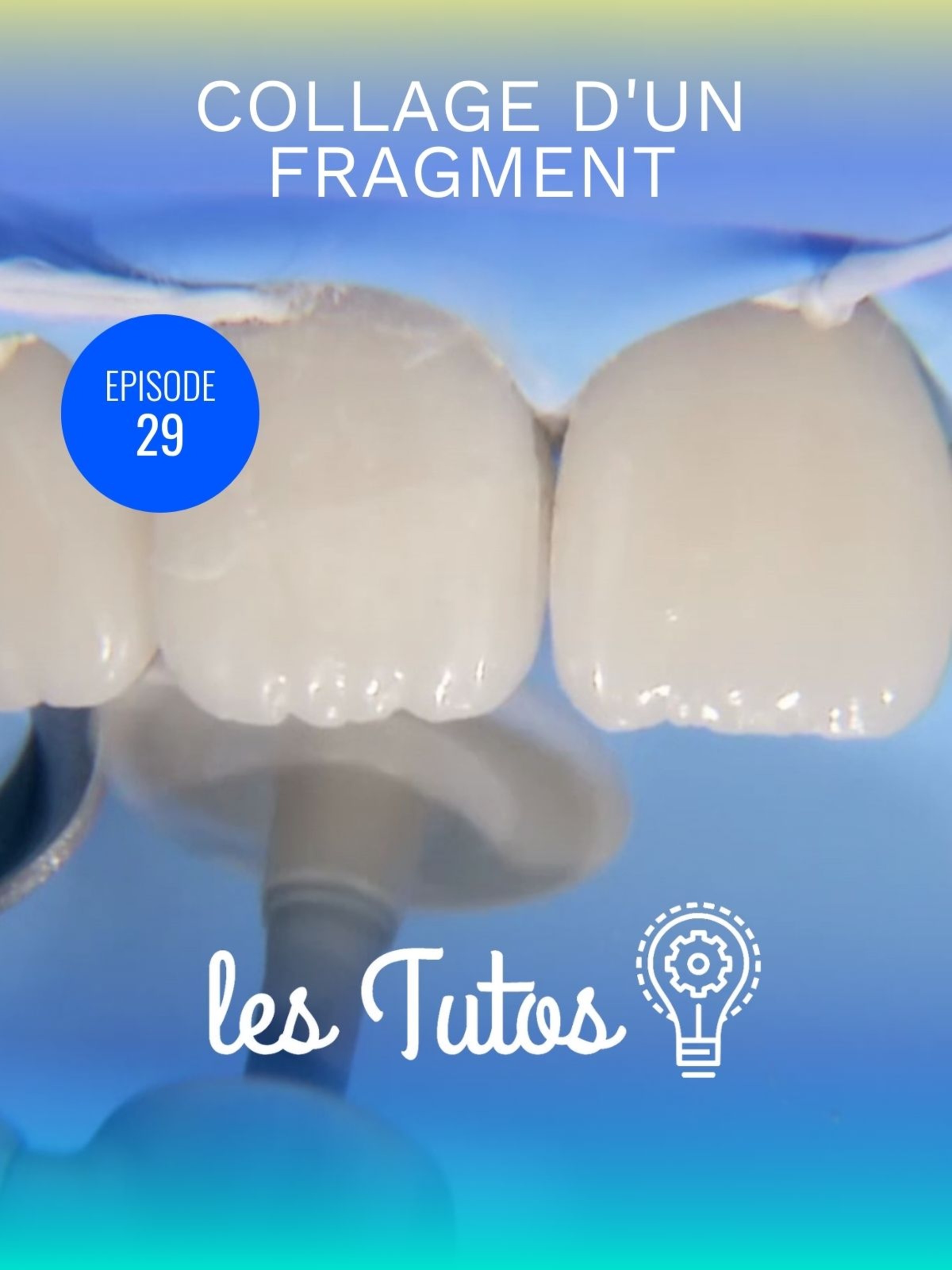 Collage d'un fragment