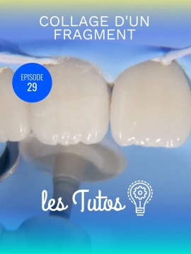 Collage d'un fragment