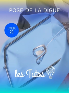 Pose de la digue Isolation d'une dent (Centrale)