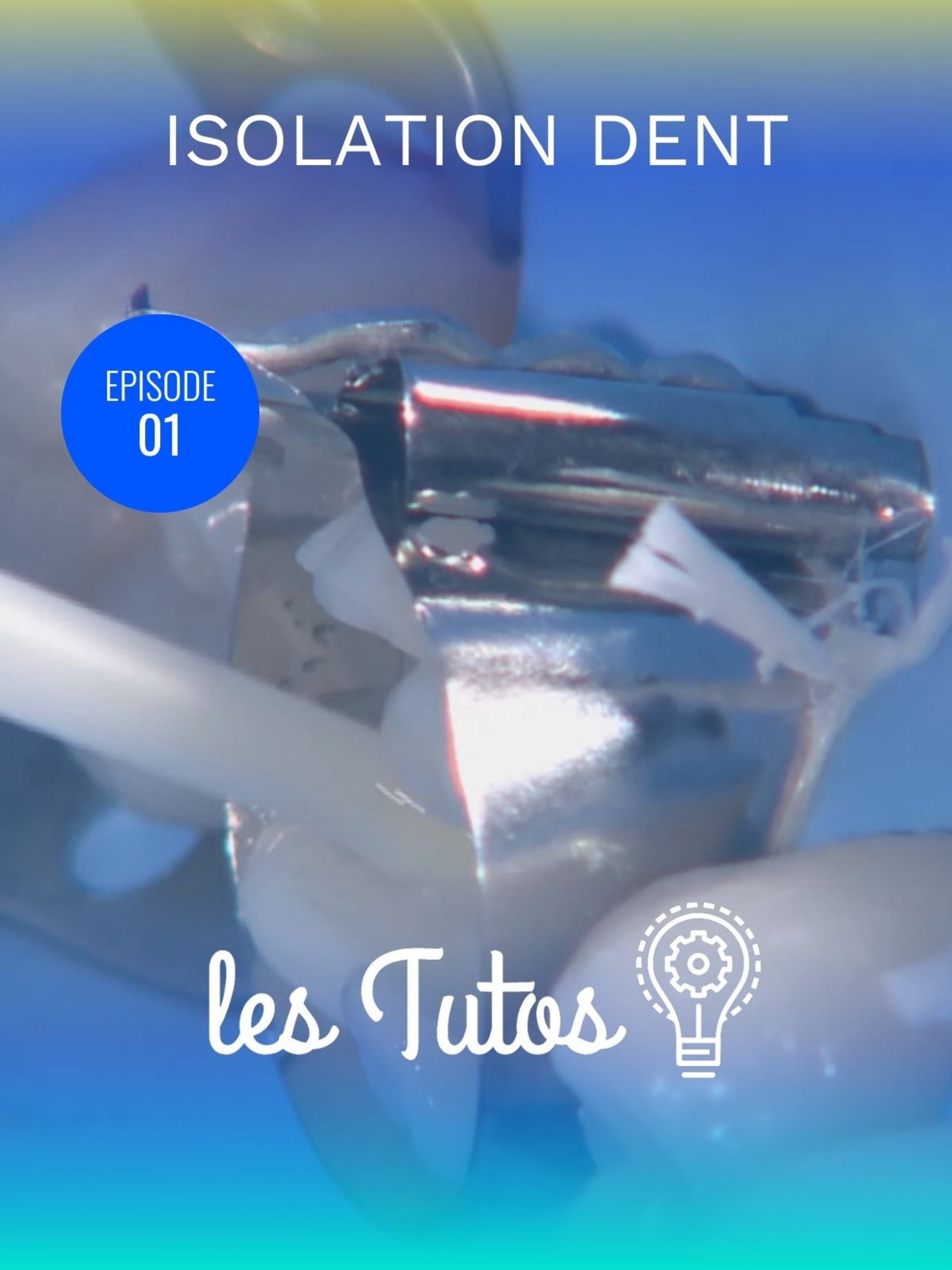 Isolation dent avec limites gingivales (36)