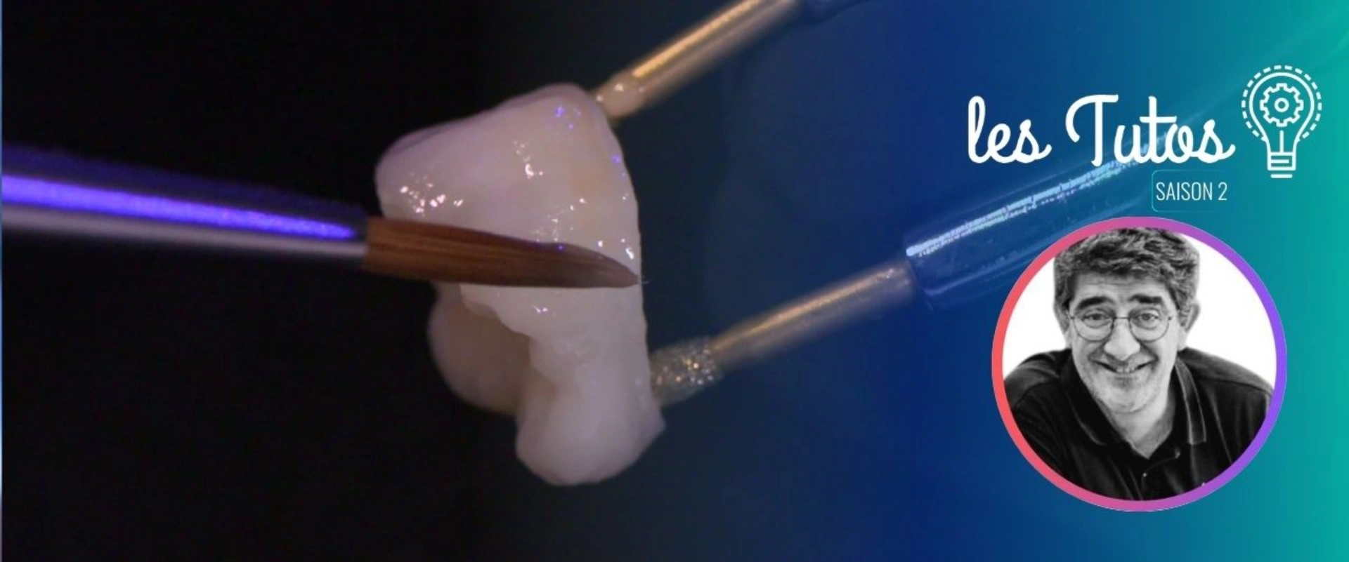 Maquillage sur molaire en zircone