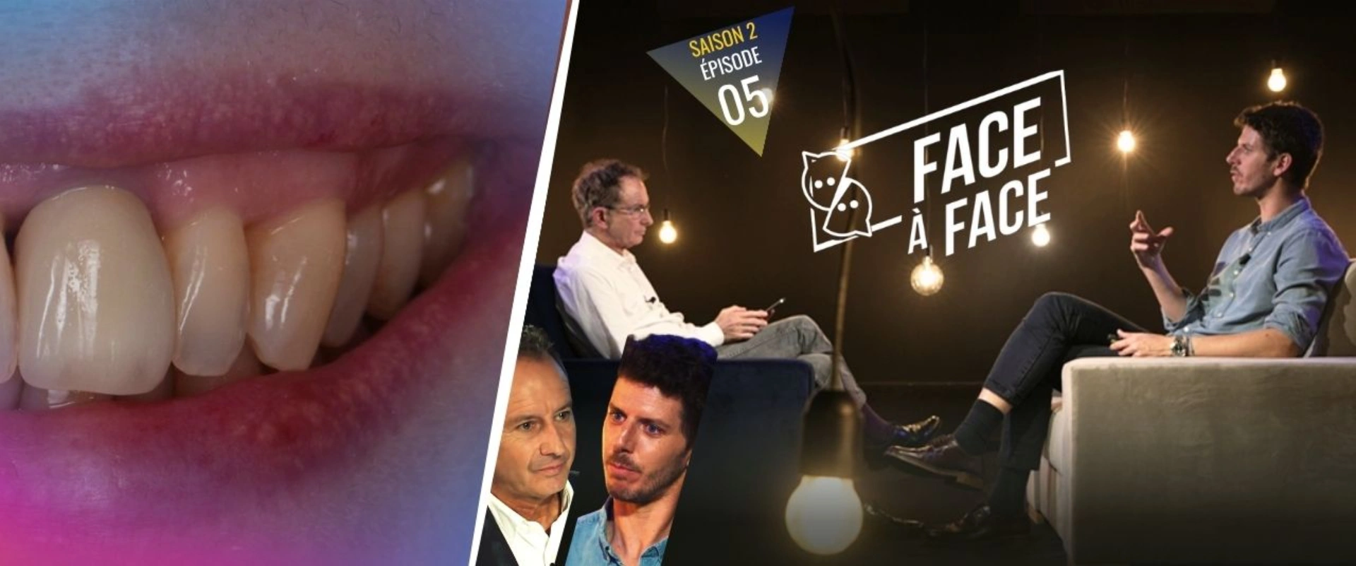 Verti-Prep BOPT Approche Edgeless