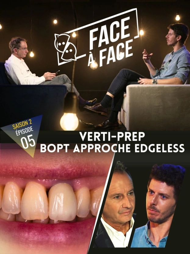 Verti-Prep BOPT Approche Edgeless