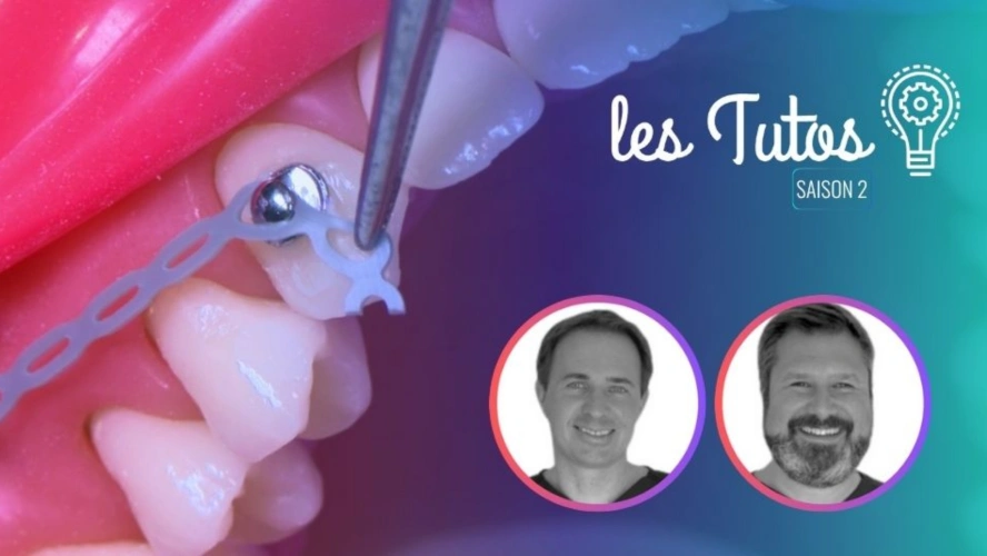 Ortho : Pose d'une mini vis