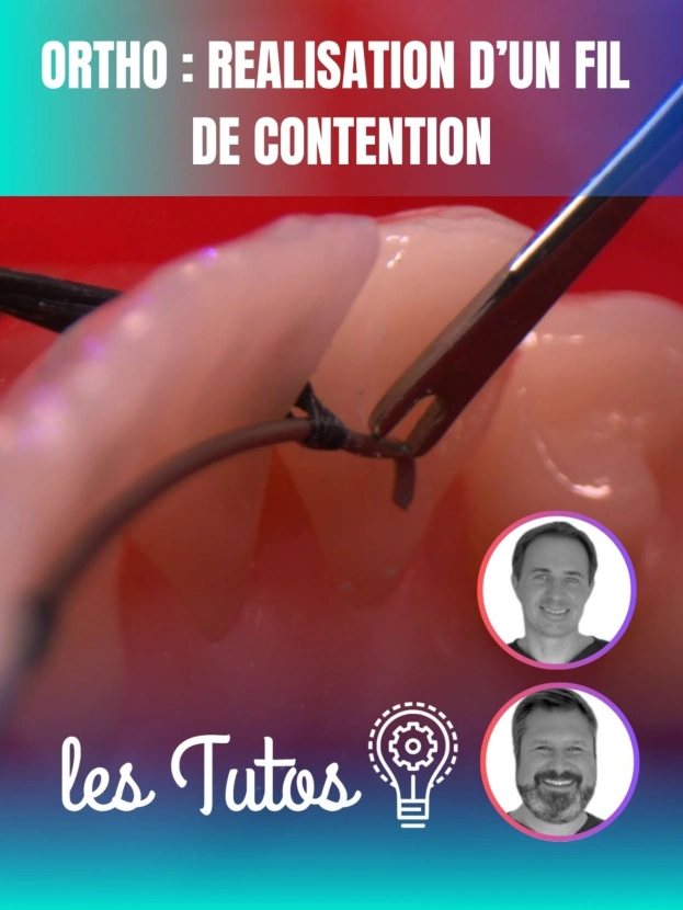 Cette semaine : Ortho : Réalisation d'un fil de contention