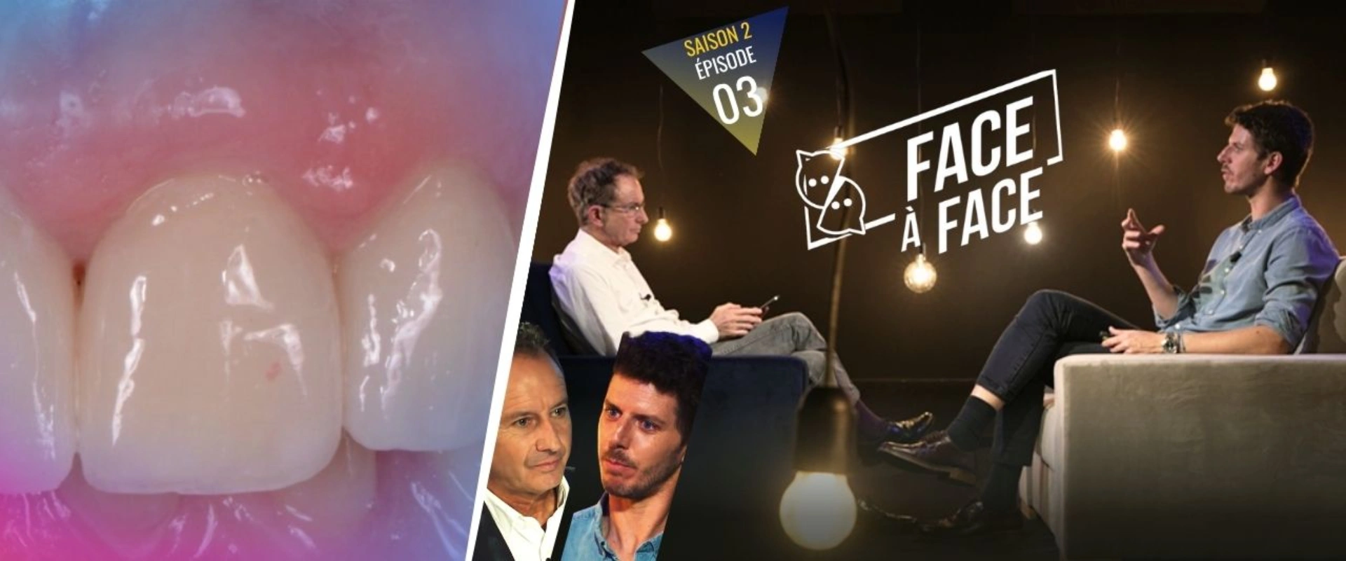 Cette semaine : Verti-Prep : Préparations horizontales Gold Standard