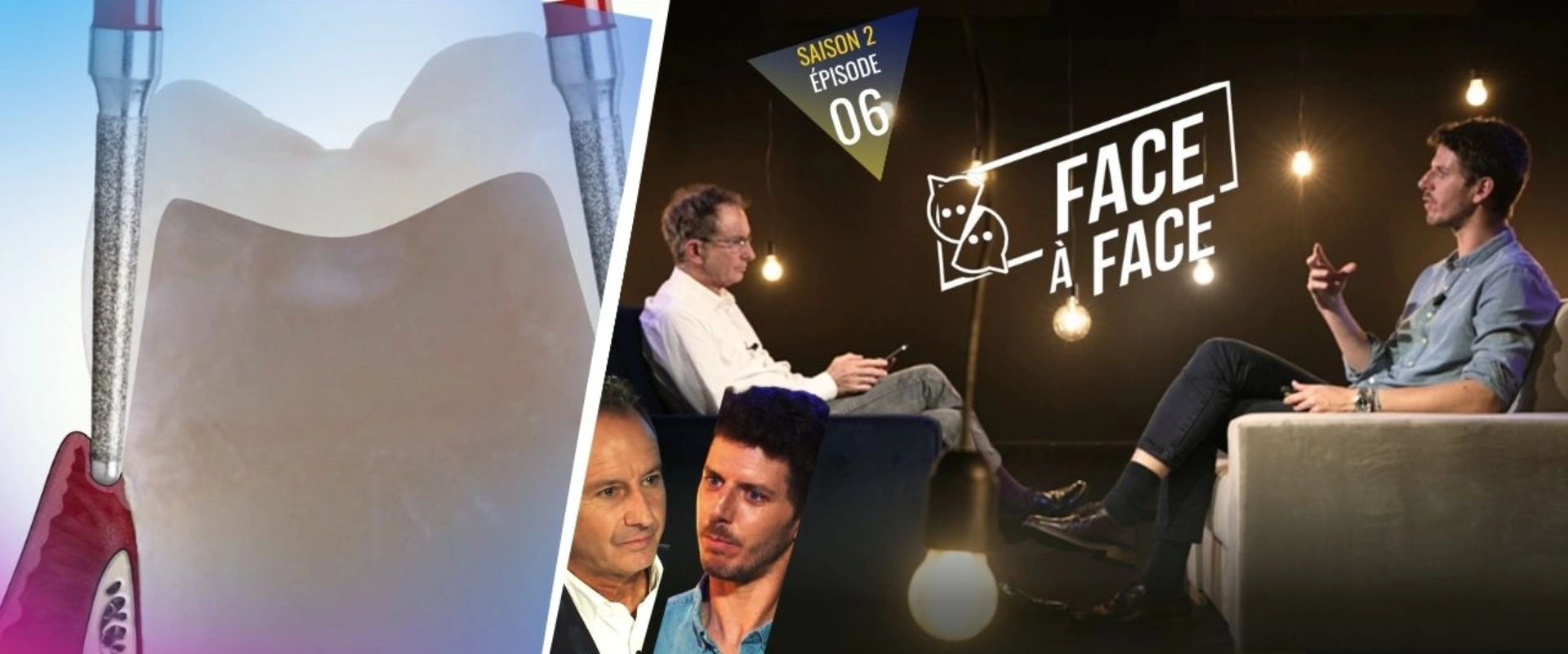 Verti-Prep : Approche Shoulderless