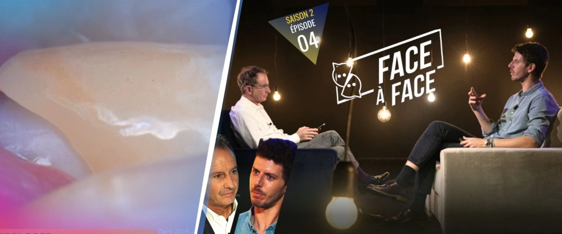 Verti-Prep : Verti-Prep et réponse parodontale