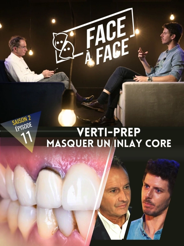 Verti-Prep : Masquer un Inlay-Core