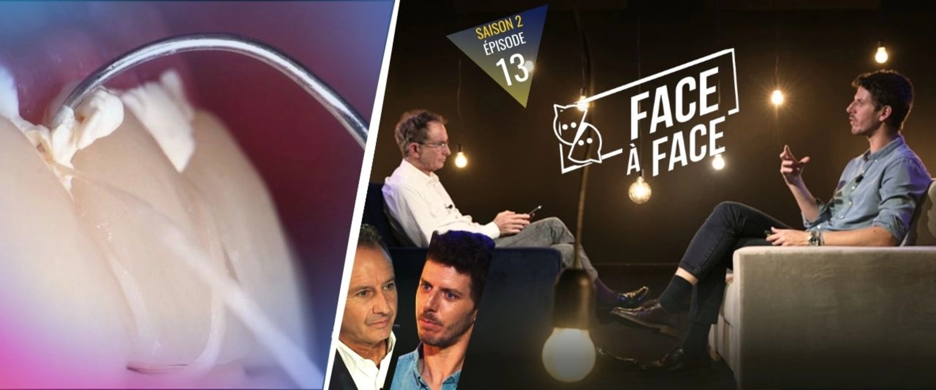 Verti-Prep : Provisoire & approche Edgeless (BOPT)